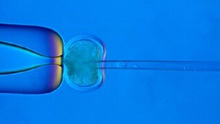 klonovanie genetika výskum mikrobiológia 1140px (ČTK)